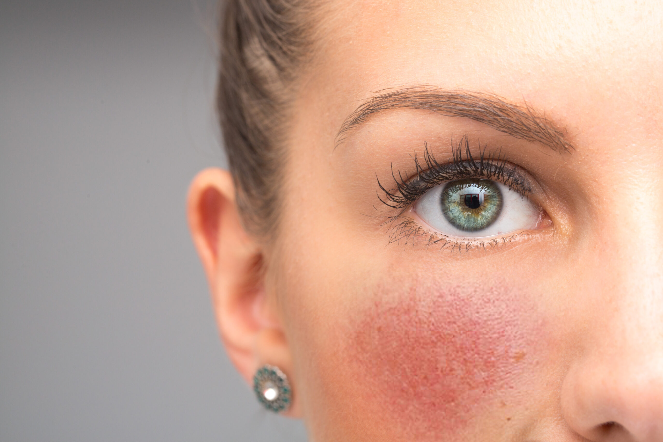 Prep Your Skin for Summer | LOOMIS | GRANITE BAY| ROCKLIN | AUBURN | ROSEVILLE| FOLSOM | LINCOLN | Dr Kismet