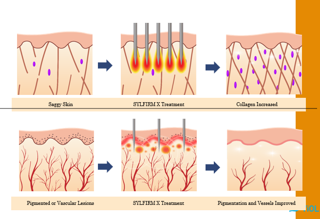 HAIR LOSS TREATMENT WHY DR. KISMET IS TRUSTED